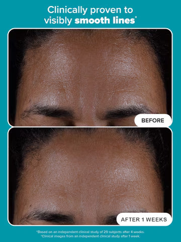 2% BHA Liquid Exfoliant