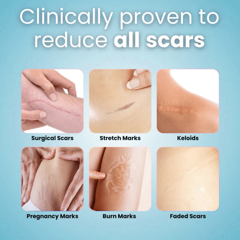 Grunsguru® Silicone Scar & Wrinkle Tape D04