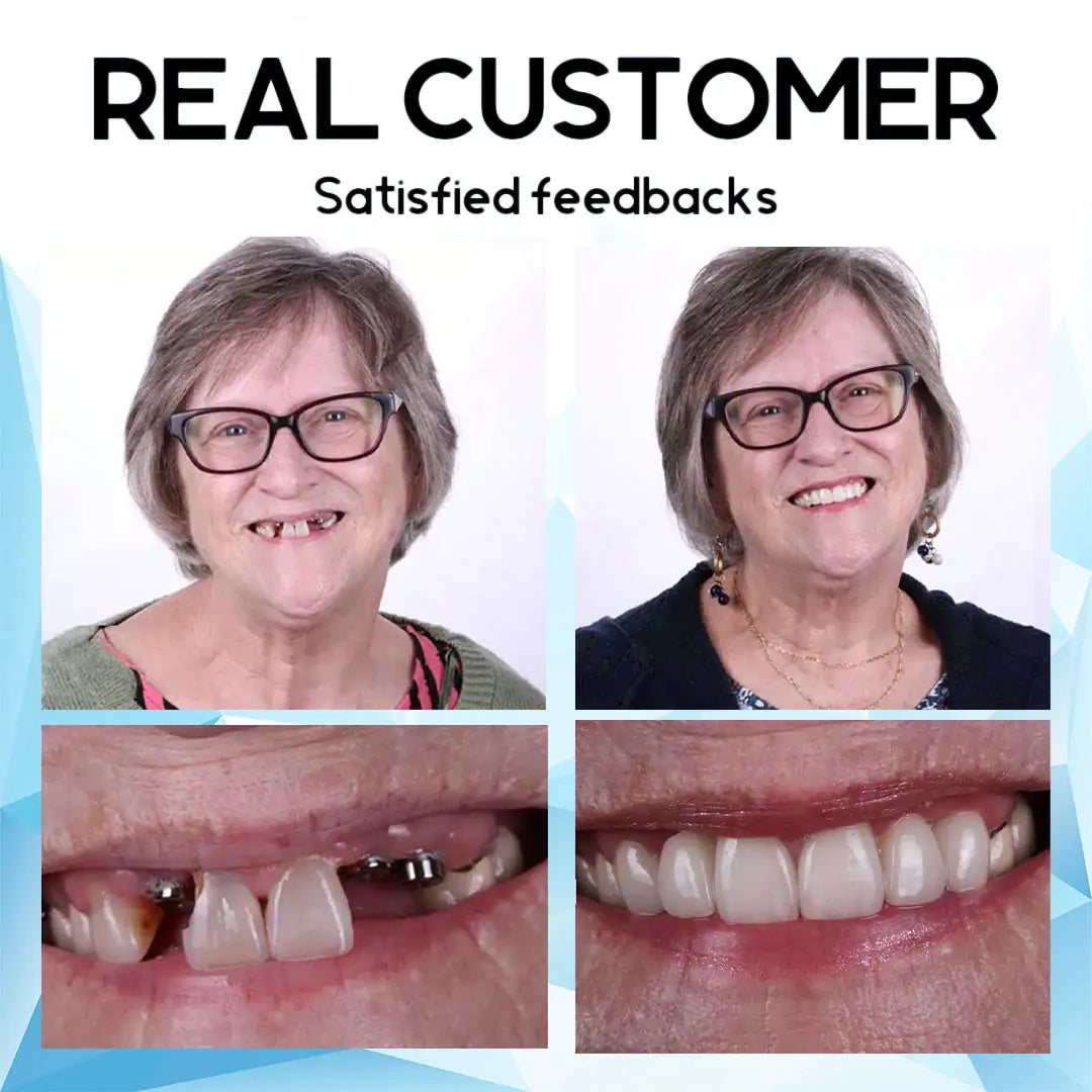 QIAWI™- Premium Custom Silicone Denture Set(Limited time discount Last 30 minutes)
