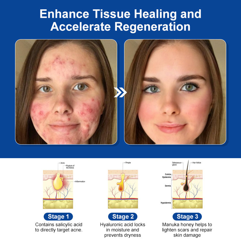 Bee Venom Skin Treatment Cream (AAD Recommended👨‍⚕️)💖💟