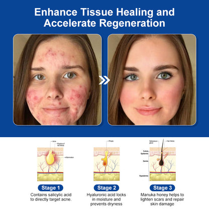 Bee Venom Skin Treatment Cream (AAD Recommended👨‍⚕️)💖💟