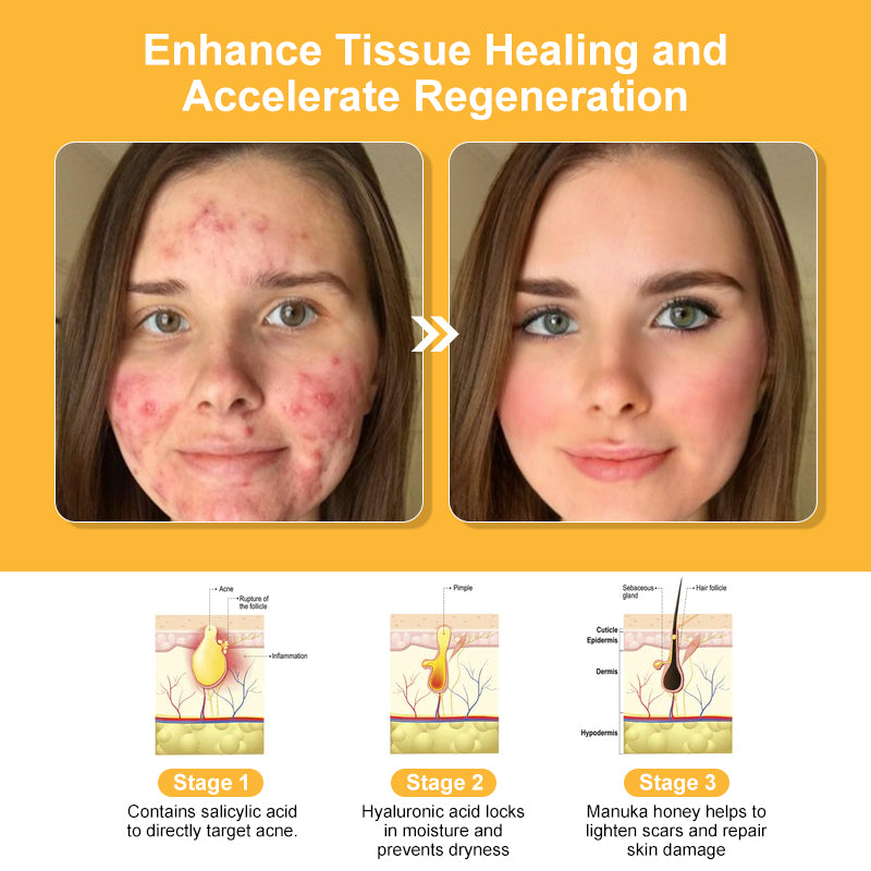🗽Made and Shipped from USA👏Bee Toxin Multi-Effect All-in-One Skincare Cream (👨‍⚕️AAD Recommended)