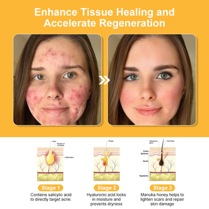 🗽Made and Shipped from USA👏Bee Toxin Multi-Effect All-in-One Skincare Cream (👨‍⚕️AAD Recommended)