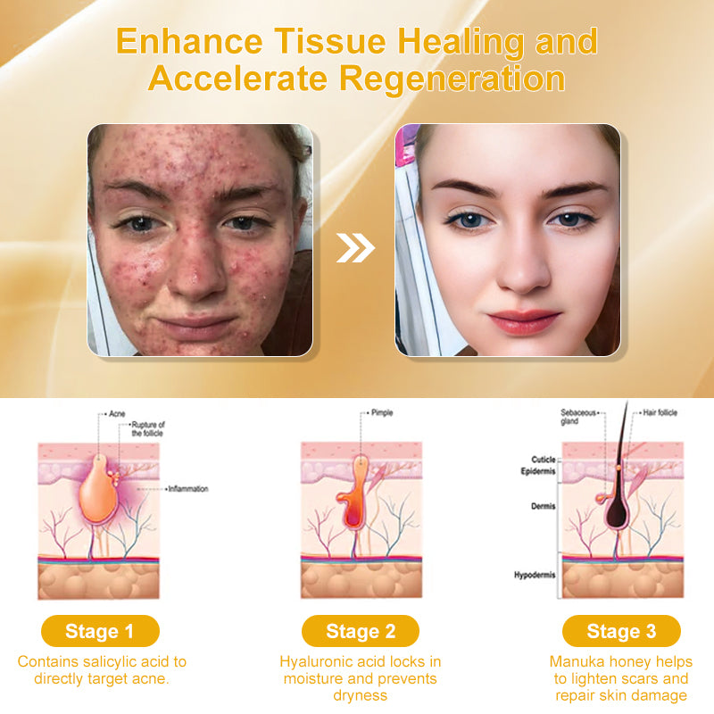 🗽Made and Shipped from USA👏Bee Toxin Skin Treatment Cream