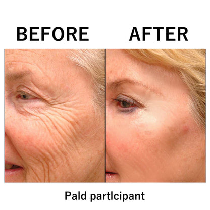 (⏰Last day offer - 50%)Instant Temporary Face Tightener🔥