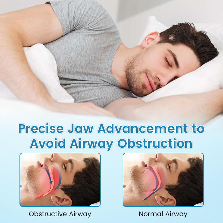 ✨ QIAWI™ Sleep & Relax Breathing Protector – Dentist-Designed