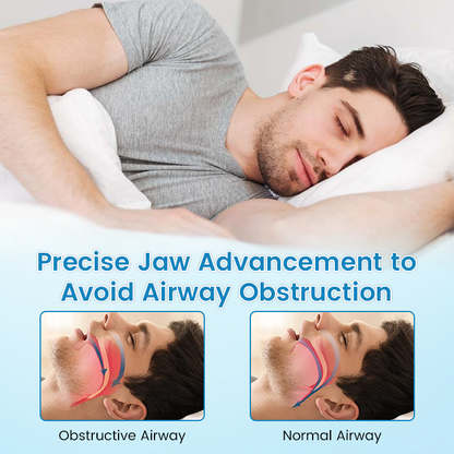 ✨ QIAWI™ Sleep & Relax Breathing Protector – Dentist-Designed