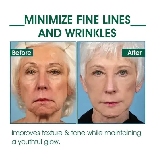 Alisanda™🔥👩‍⚕️Last Day Promotion 𝟕𝟎%𝐎𝐅𝐅 - SkinFirming Rejuvenating Serum🔥