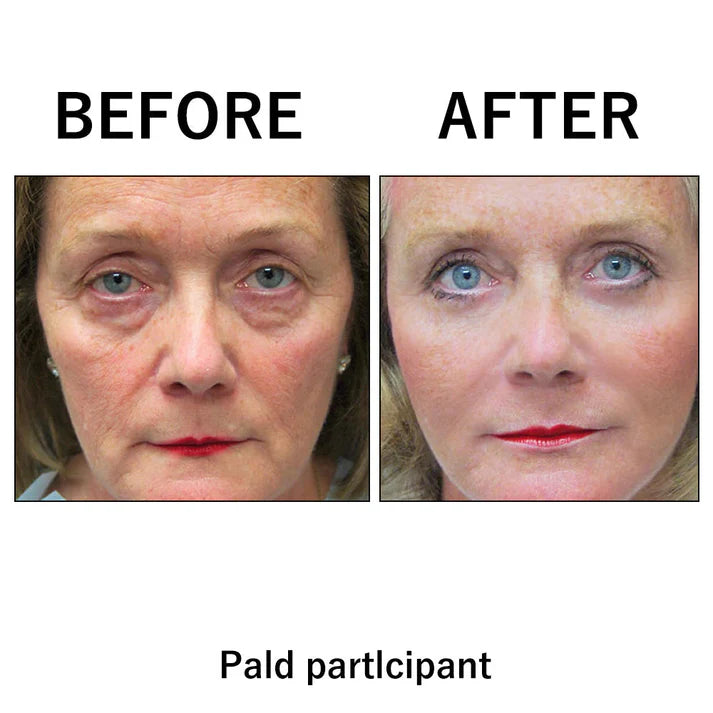(⏰Last day offer - 50%)Instant Temporary Face Tightener🔥