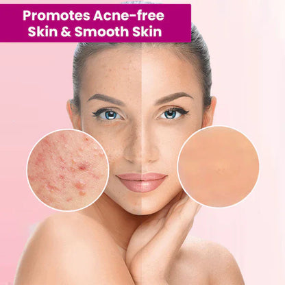 🎁🎁BUY 2 GET 1 FREE🎁LOVILDS™ Tags & Moles Remover