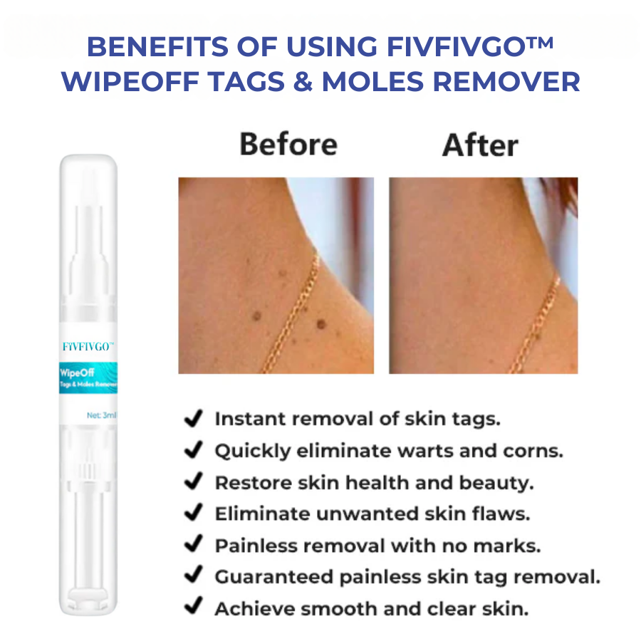 LOVILDS™ WipeOff Tags & Moles Remover✅ADA Approved